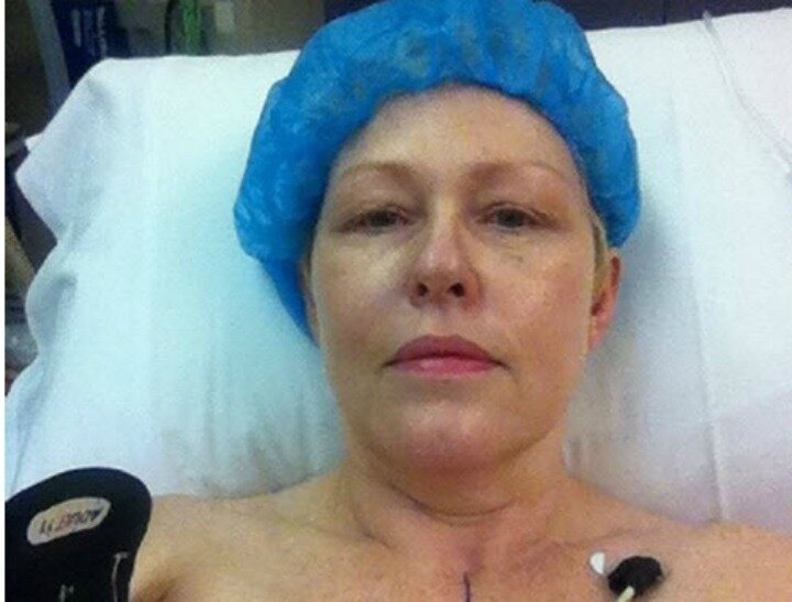 Breast-cancer-masectomy-feature